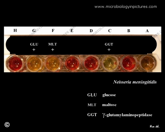 neisseria meningitidis, identification with a commercial kit